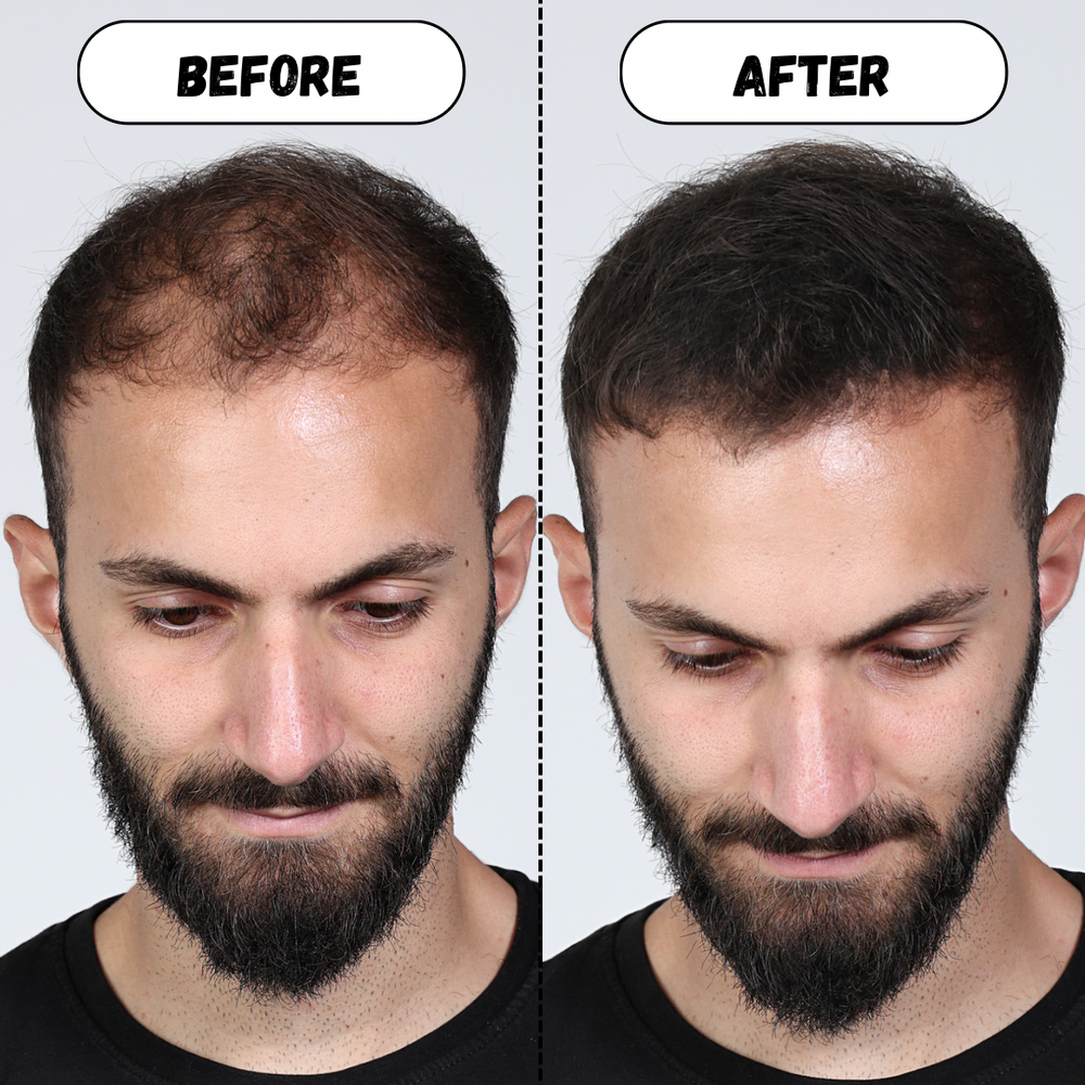 Fiber Flex™ Hair Building Fibers